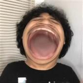 Trái