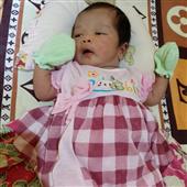 Mắt