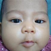 Bản