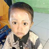 Anh 