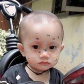 Mặt 