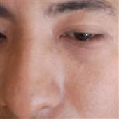 Chơ
