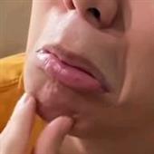Bản