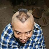 Kết 